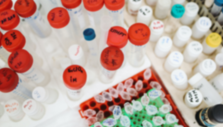 瓶胚的成型是怎样的？生产工艺又是怎样的？